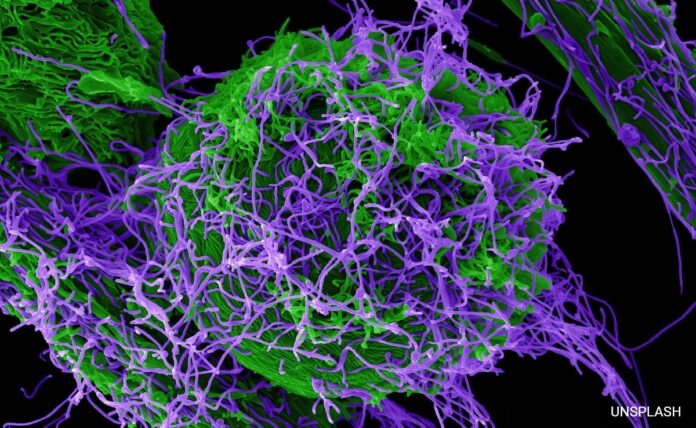 <h1>red-cross-raises-alarm-over-potential-ebola-outbreak-in-conflict-ridden-goma,-dr-congo</h1>